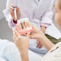 dental implants service photo