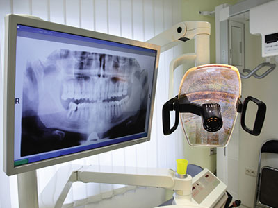digital x-rays photo