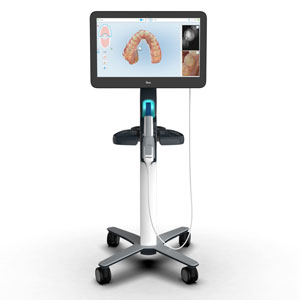 iTero® digital scanner photo