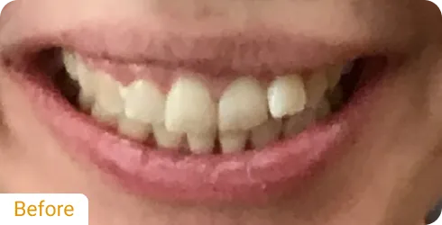 Before